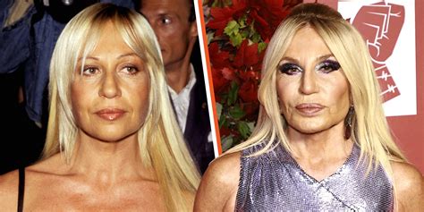 donatella versace surgery|donatella versace facelift.